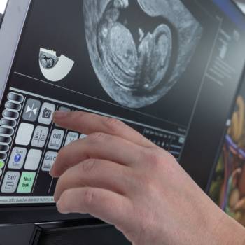 ScanTrainer – University of Hertfordshire